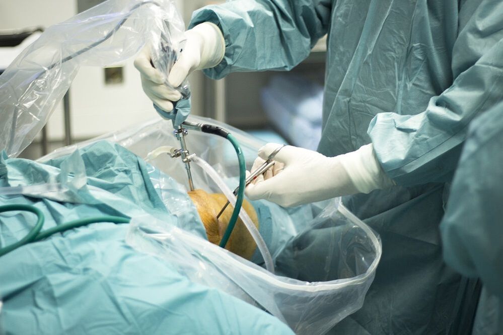 chirurgische behandeling van artrose