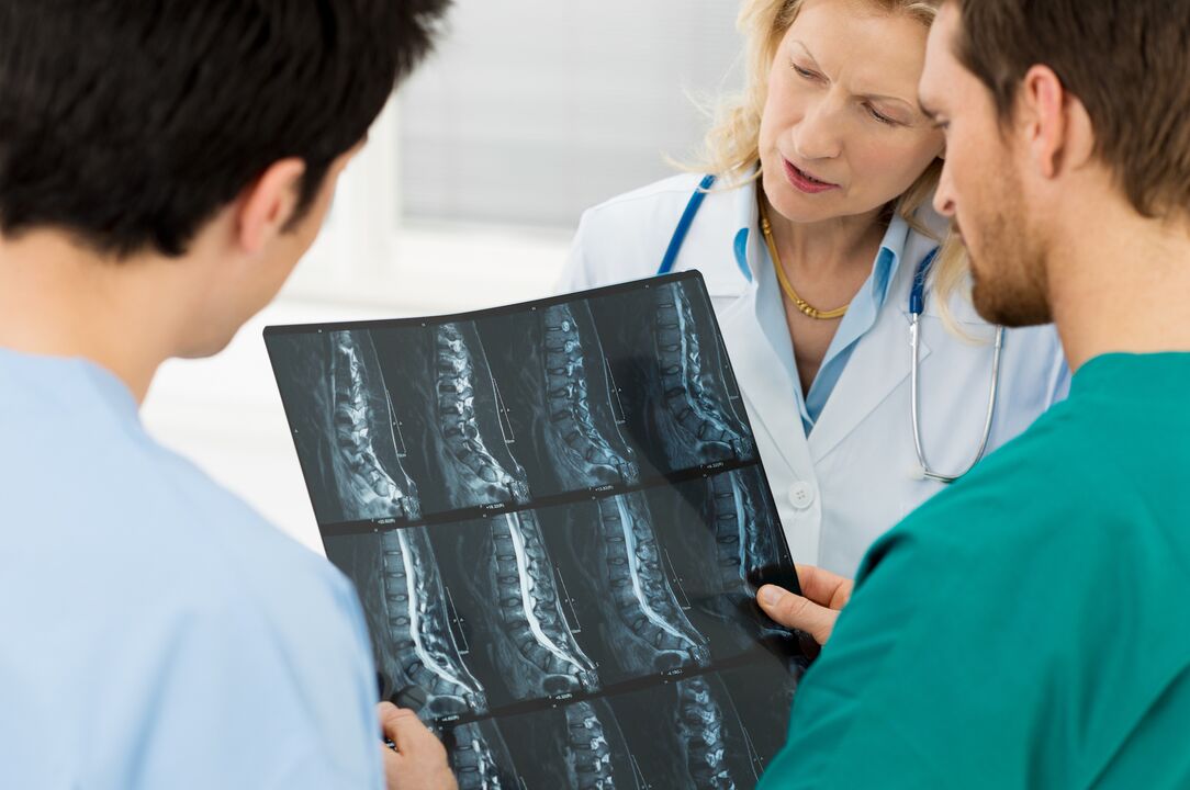 osteochondrose diagnostiek